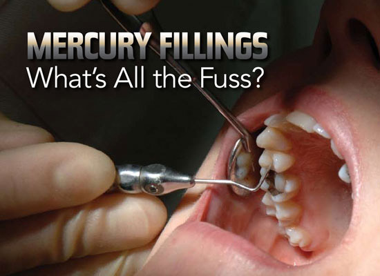 Mercury Fillings - What's all the fuss